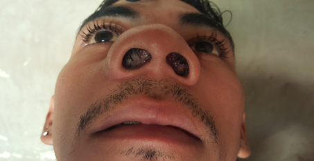Elbin Antonio Cruz 2.png