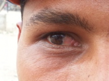 Ojo.jpg
